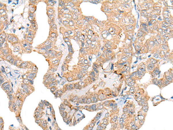 CNTN4 Antibody