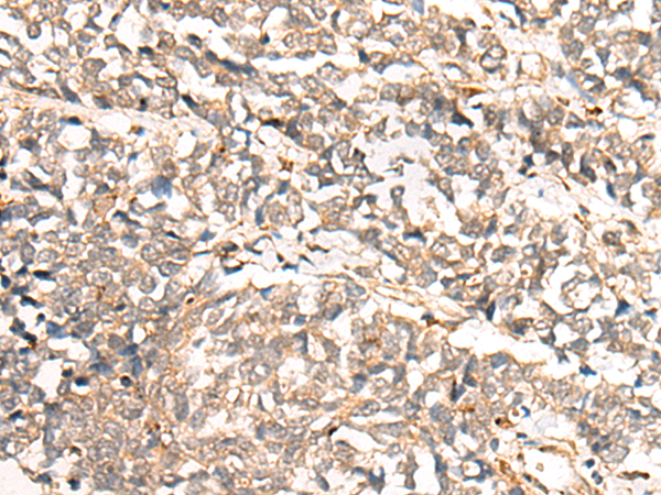 COMMD1 Antibody