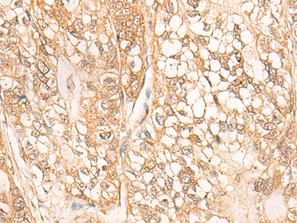 CPS1 Antibody