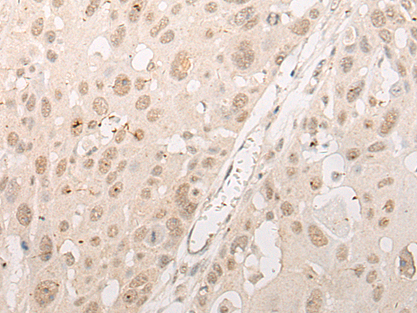 CPSF1 Antibody