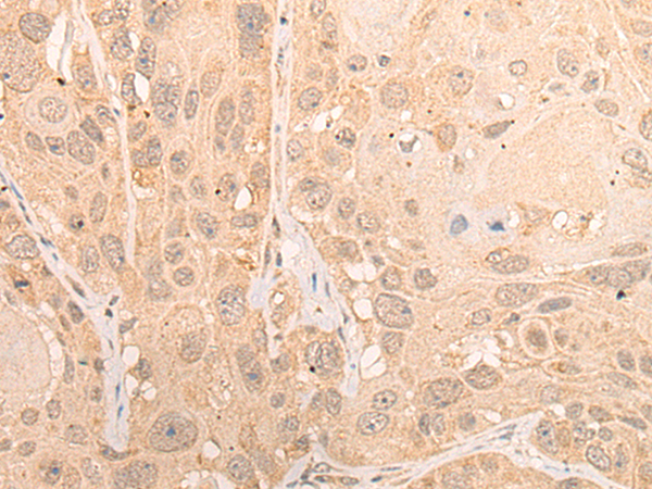 CPSF2 Antibody