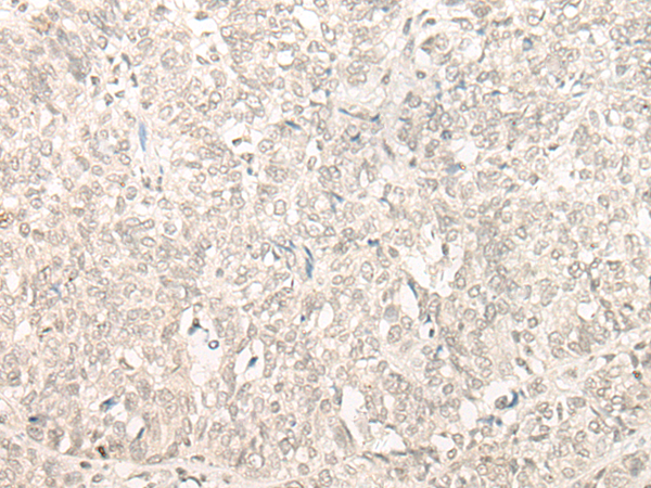 CPSF3L Antibody