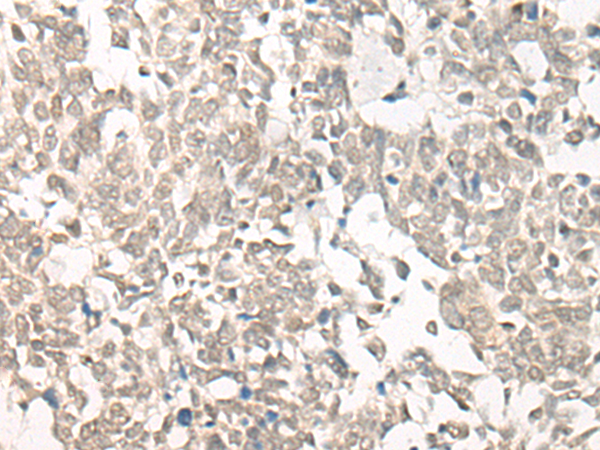 CPSF3L Antibody