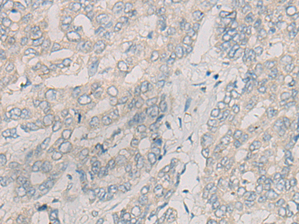 CR1L Antibody