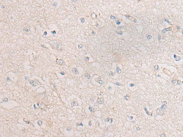 CR1L Antibody