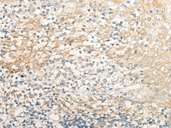 CRB3 Antibody