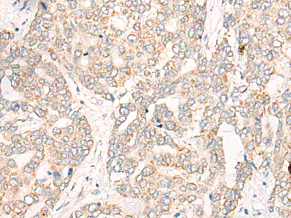 CREB3L2 Antibody