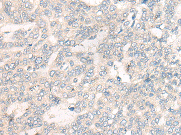 CRISP1 Antibody