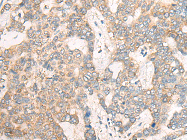 CSNK1G1 Antibody