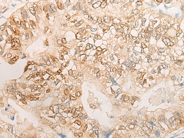 CTNND2 Antibody