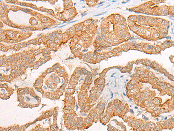 CYB5D1 Antibody