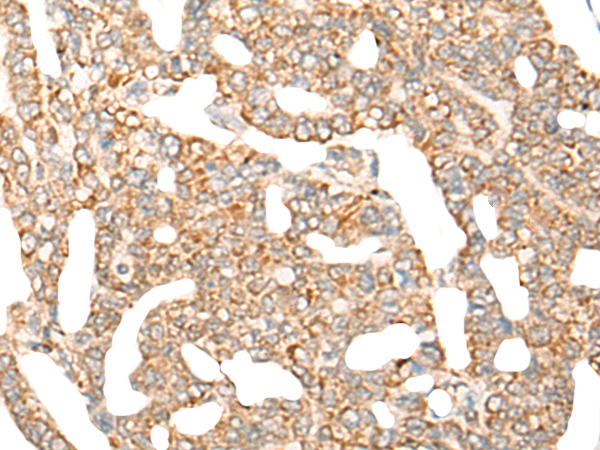 CYB5R1 Antibody