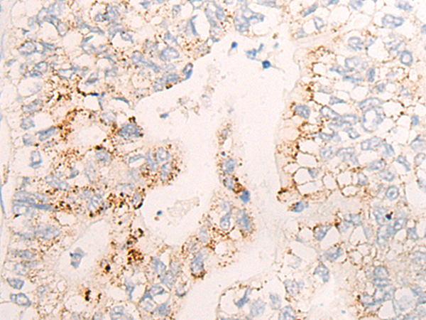 CYP26C1 Antibody