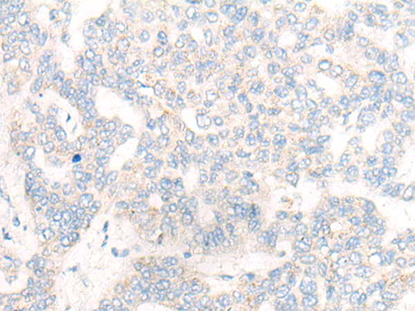 CYP26C1 Antibody