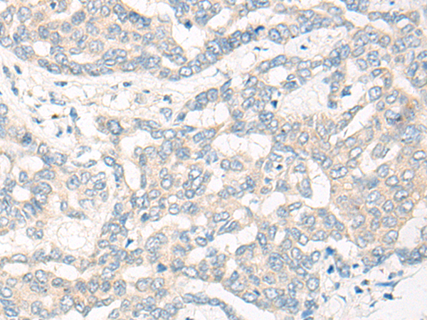 CYP2R1 Antibody