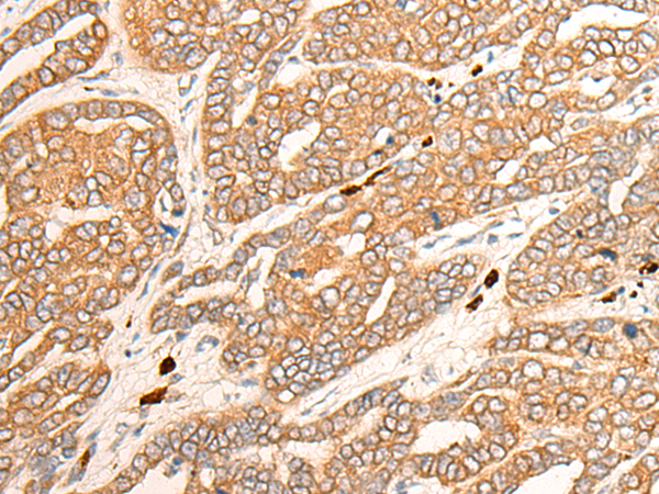 CYP3A43 Antibody