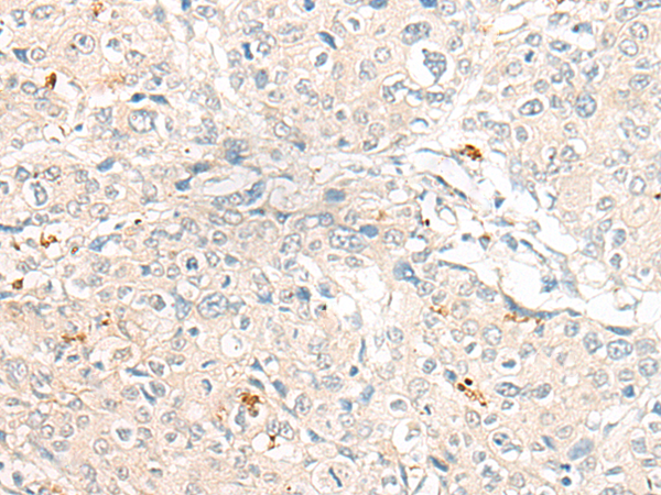 CYP3A5 Antibody