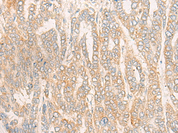 CYP4F12 Antibody