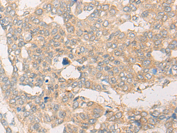 CYP7B1 Antibody