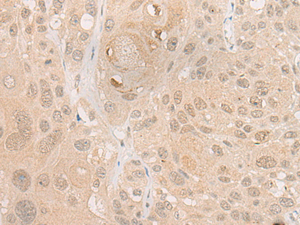 CYP7B1 Antibody