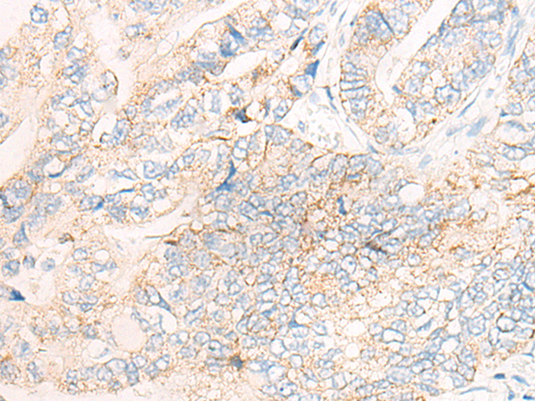 CYSLTR2 Antibody