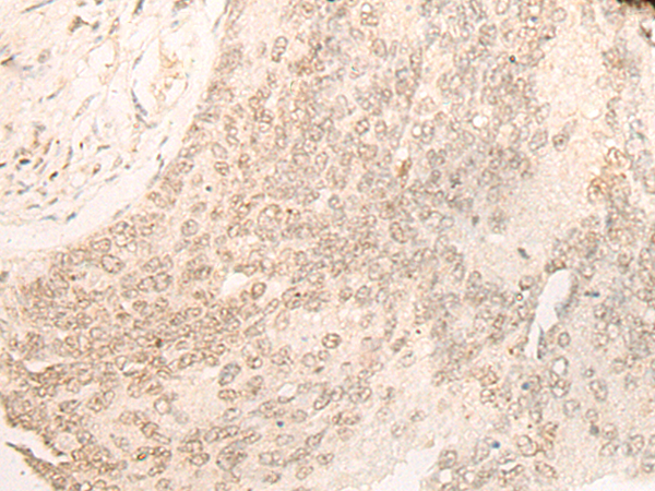 DACT1 Antibody