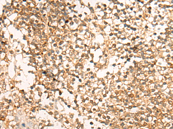 DACT1 Antibody