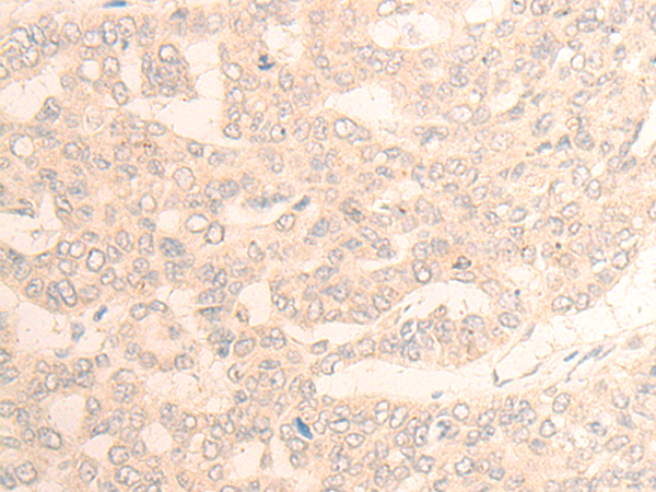 DAGLB Antibody