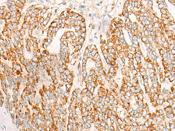 DAOA Antibody