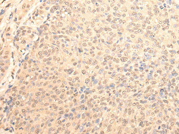 DAZ1 Antibody