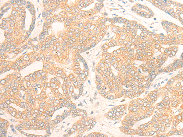 DDHD1 Antibody