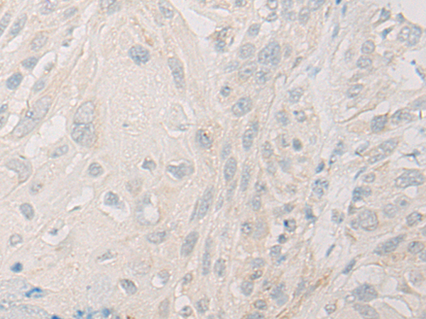 DDX19A Antibody