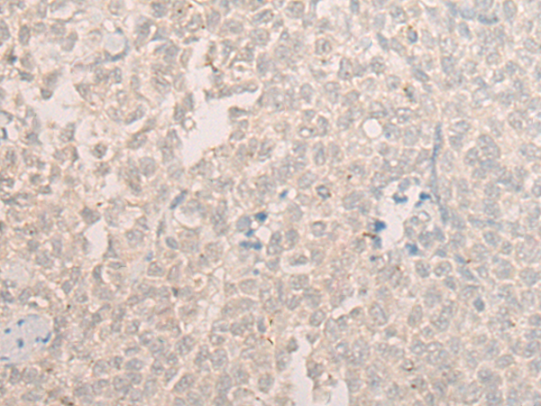 DDX19A Antibody