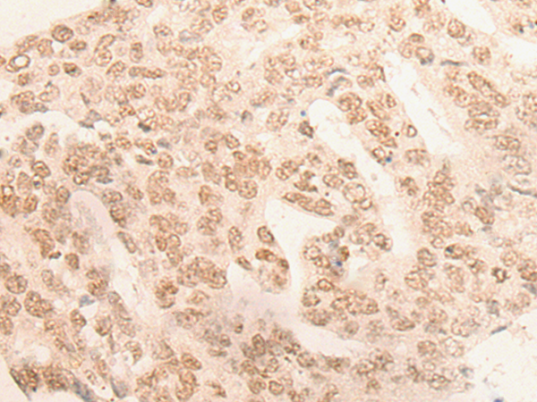 DDX42 Antibody