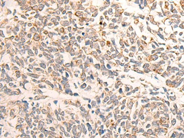 DDX54 Antibody