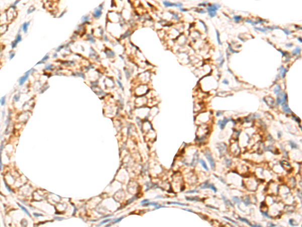 DDX54 Antibody