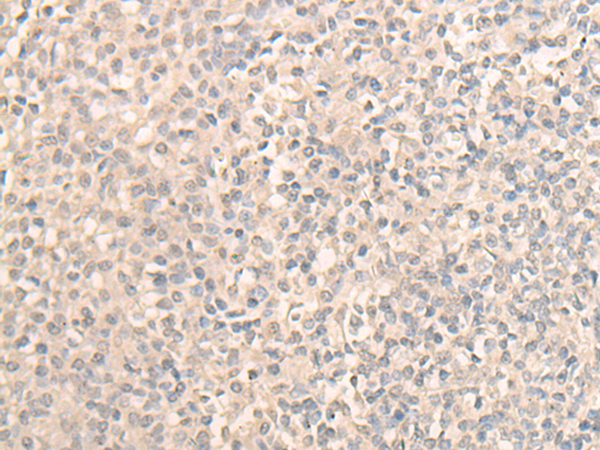 DDX59 Antibody