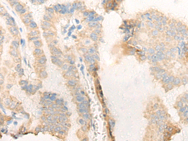 DENND1B Antibody