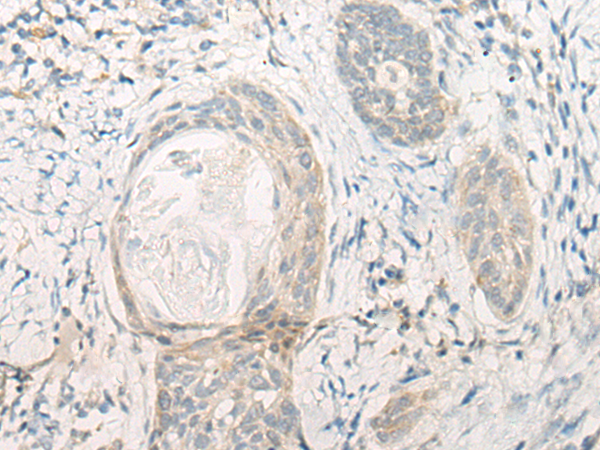 DENND1B Antibody