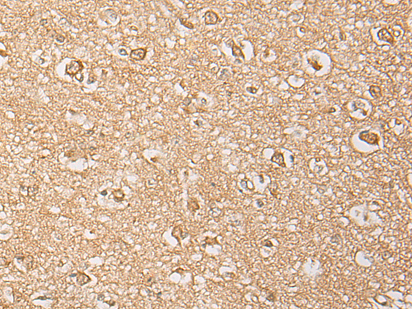 DGCR6 Antibody