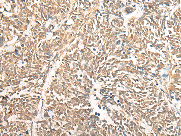 DGCR6 Antibody