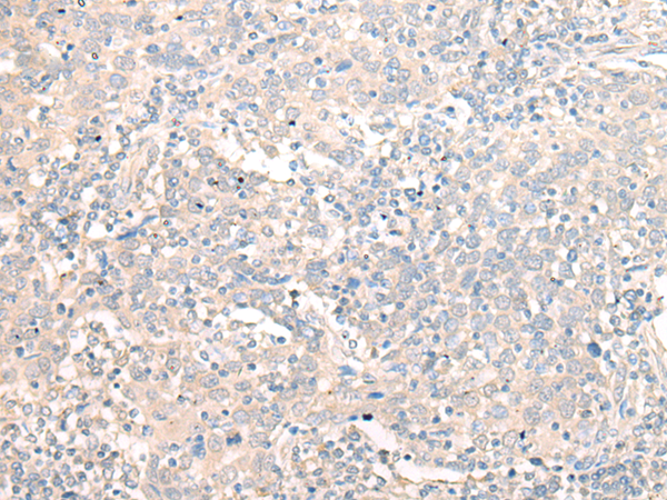 DHRS1 Antibody