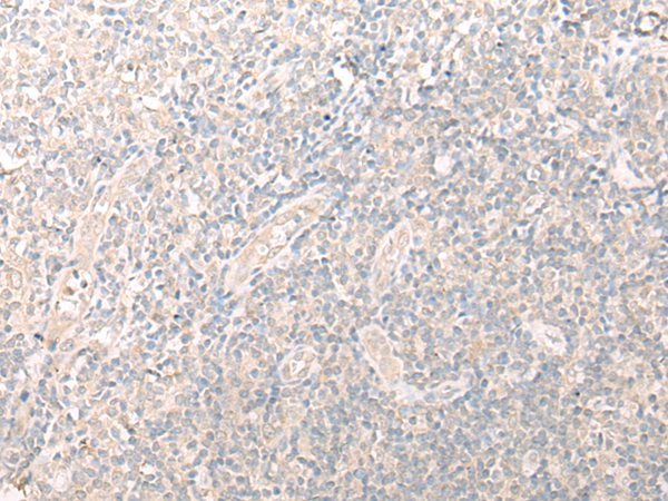 DHRS1 Antibody