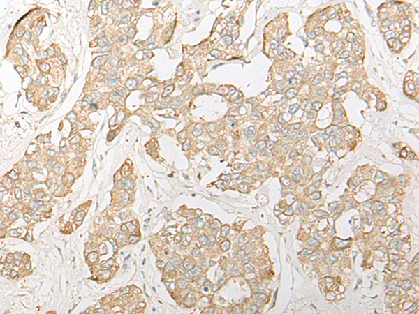 DHRS7 Antibody