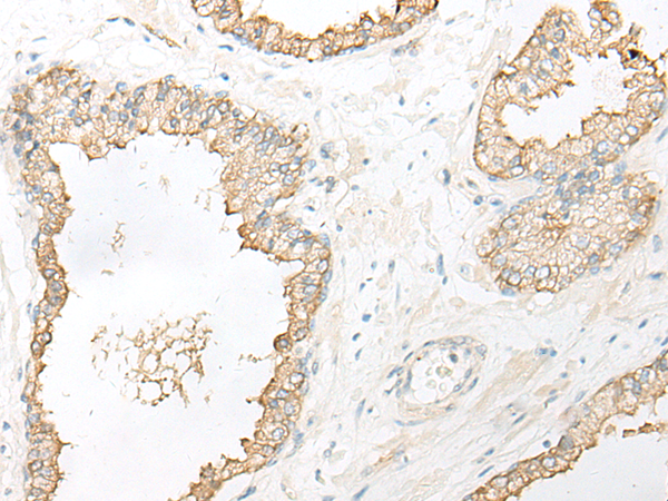 DHRS7 Antibody