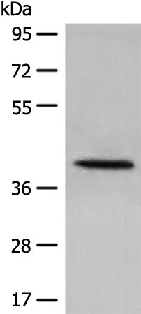 DHRS7 Antibody