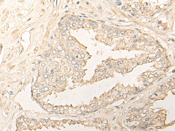 DIMT1 Antibody