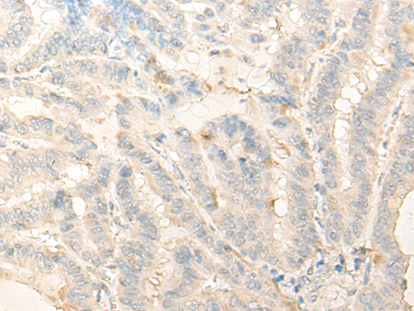 DIMT1 Antibody