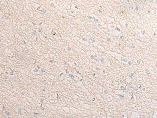 DIXDC1 Antibody