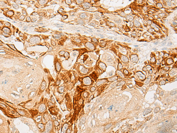 DKKL1 Antibody